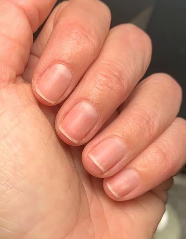 Ongles ternes avant le sérum