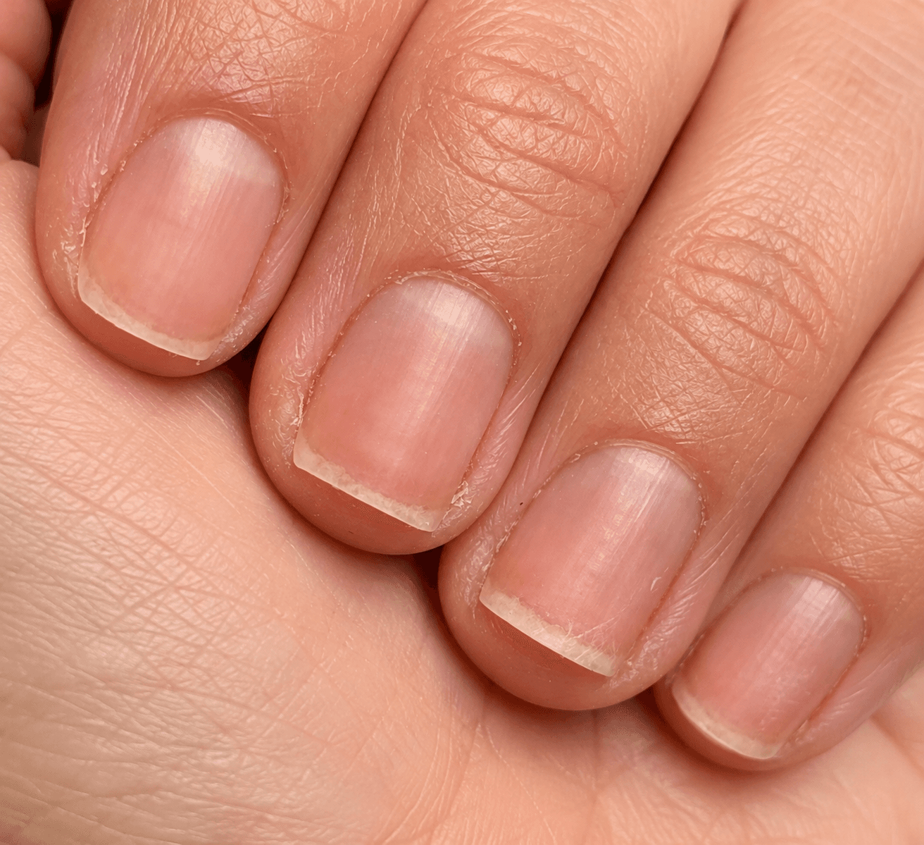 Ongles naturels courts avec cuticules sèches avant une routine de soin des ongles CBM.